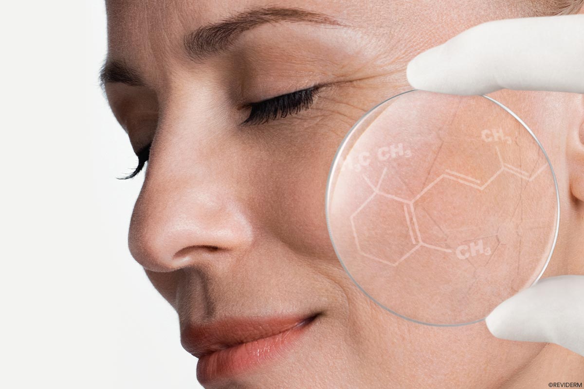 pca peeling